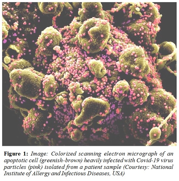 Figure 1: Image: Colorized scanning electron micrograph of an apoptotic cell (greenish-brown) heavily infected with Covid-19 virus particles (pink) isolated from a patient sample (Courtesy: National Institute of Allergy and Infectious Diseases, USA)